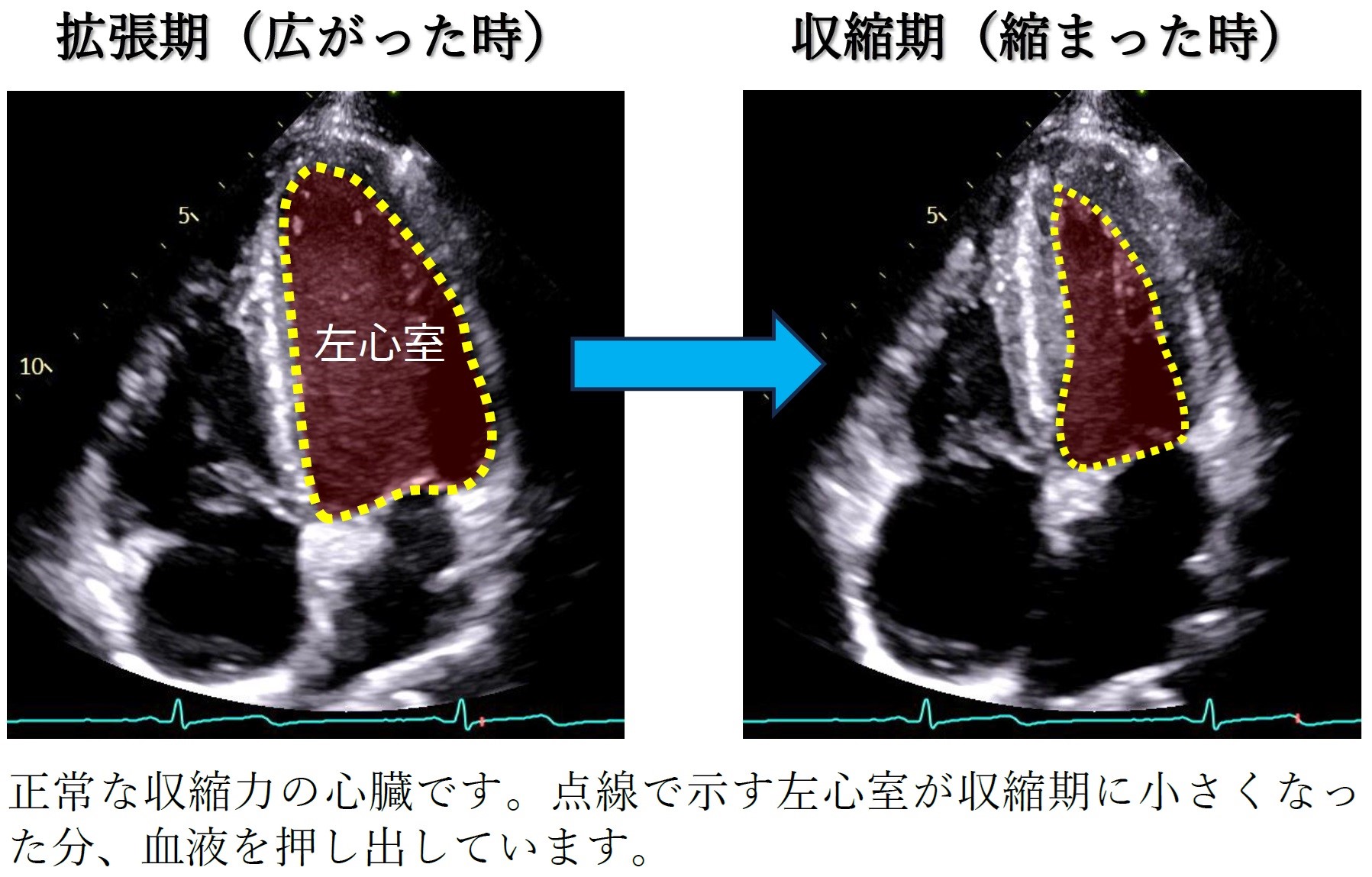 Heart Image