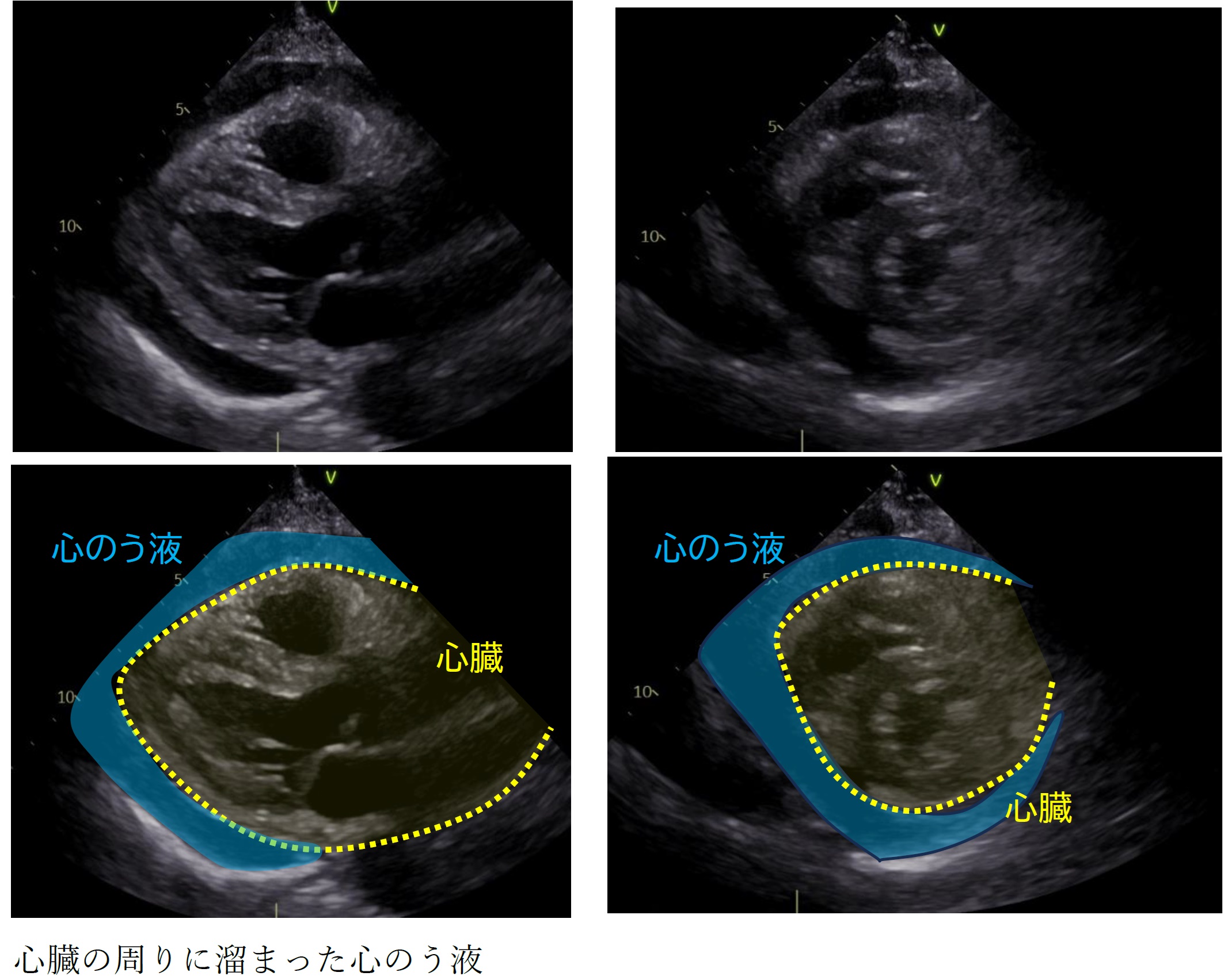 Heart Image