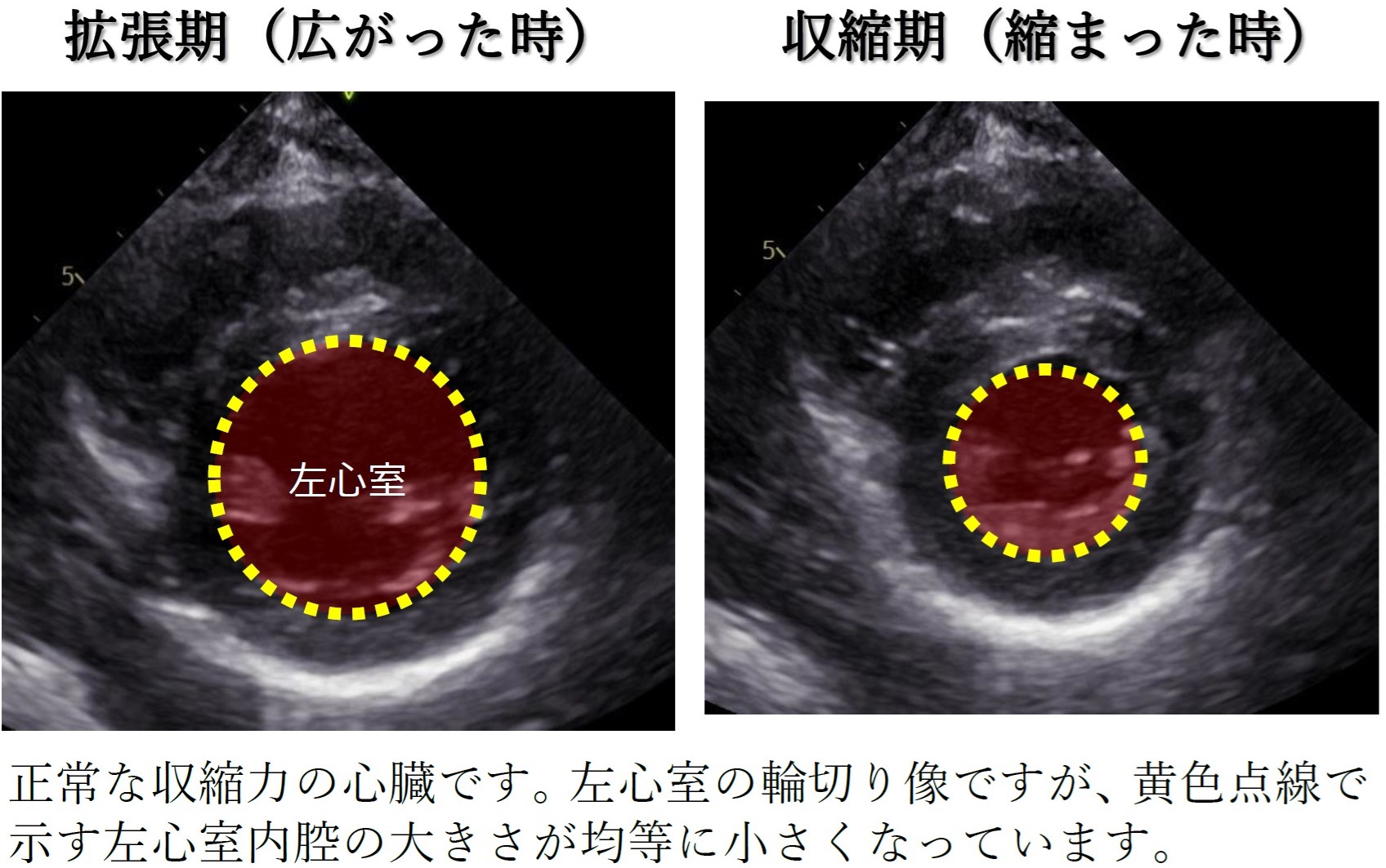 Heart Image