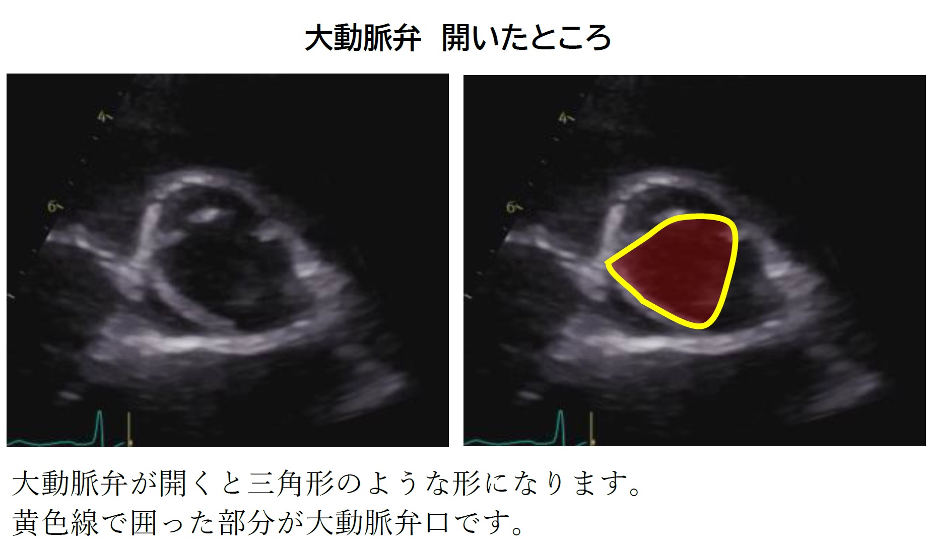 Heart Image