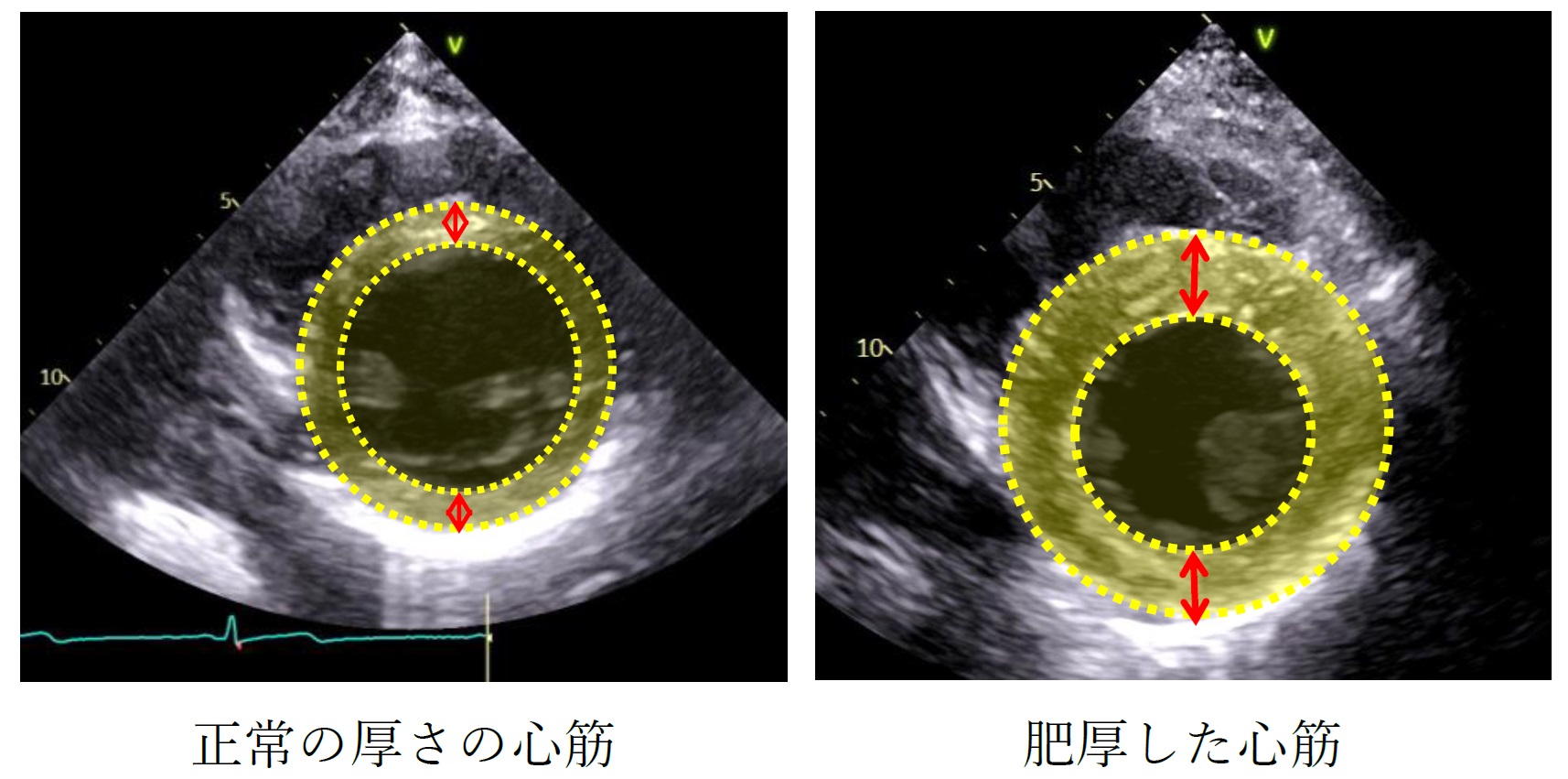 Heart Image